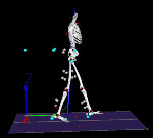 Gait Training in Patients with Diabetic Peripheral Neuropathy